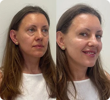 Client
